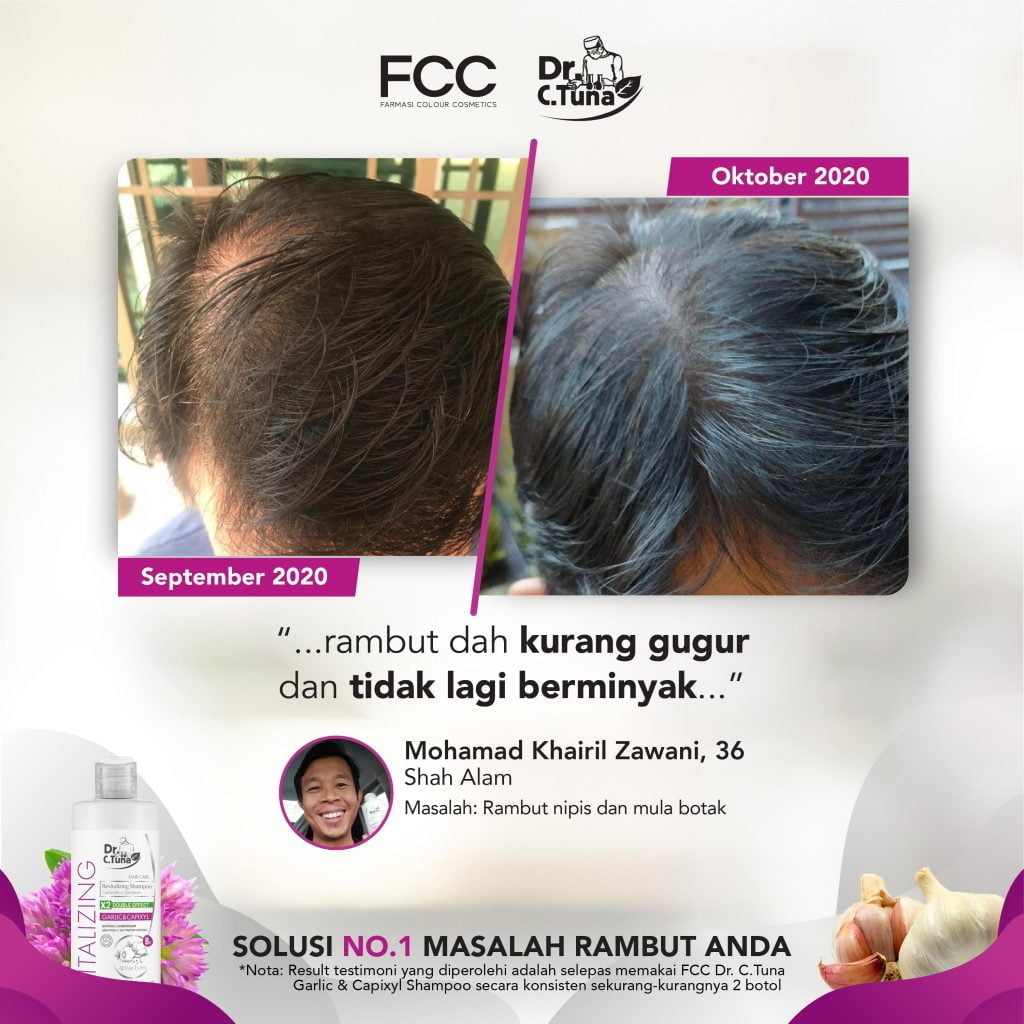 GARLIC SHAMPOO TESTIMONIAL-REVISED-05