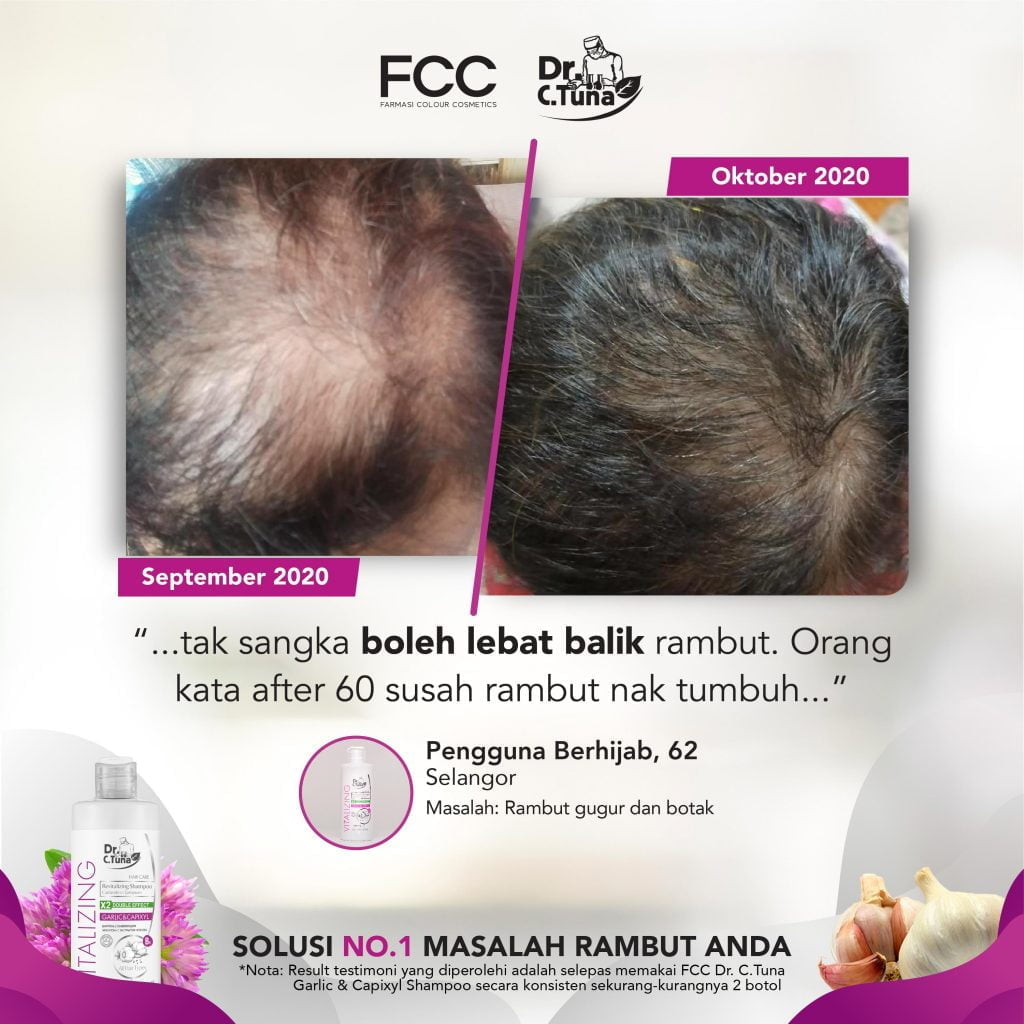 GARLIC SHAMPOO TESTIMONIAL-REVISED-08