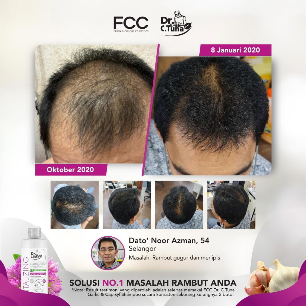 GARLIC SHAMPOO TESTIMONIAL-REVISED-11