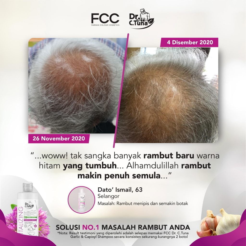 GARLIC SHAMPOO TESTIMONIAL-REVISED-12