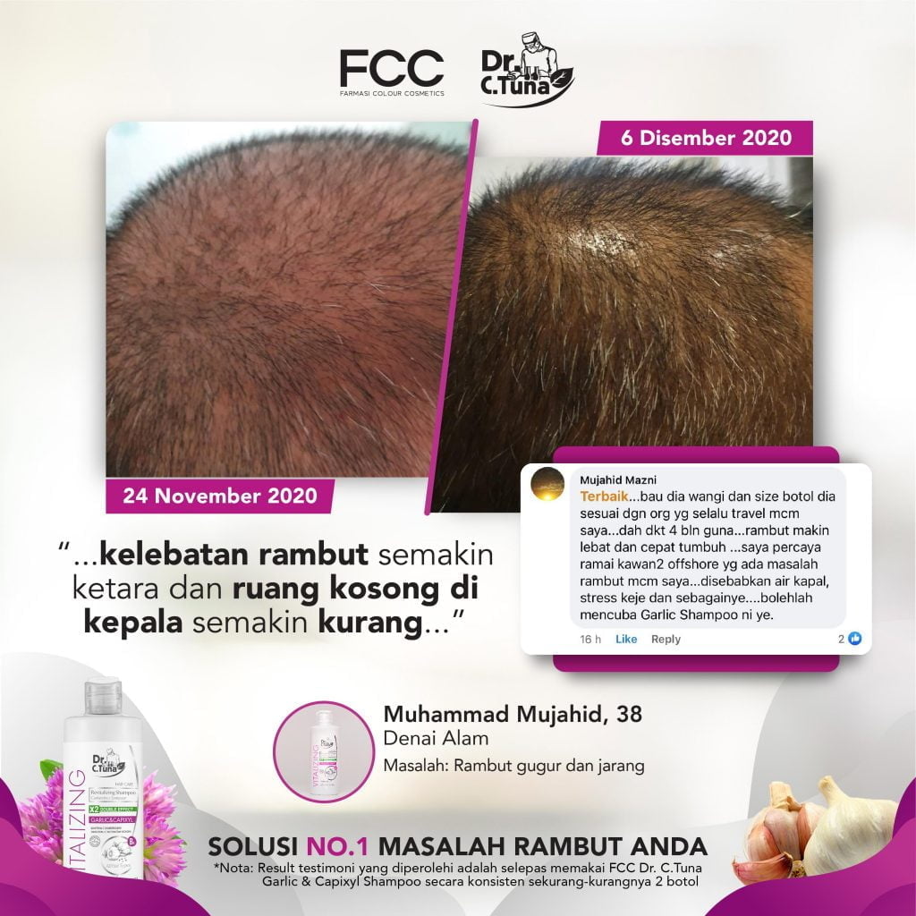 GARLIC SHAMPOO TESTIMONIAL-REVISED-15