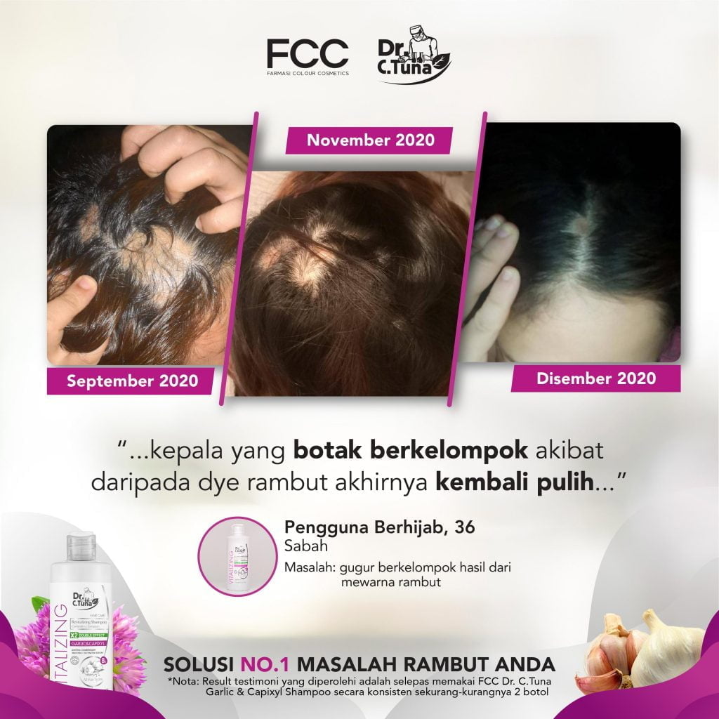 GARLIC SHAMPOO TESTIMONIAL-REVISED-16